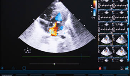 Advanced Heart Diagnostics